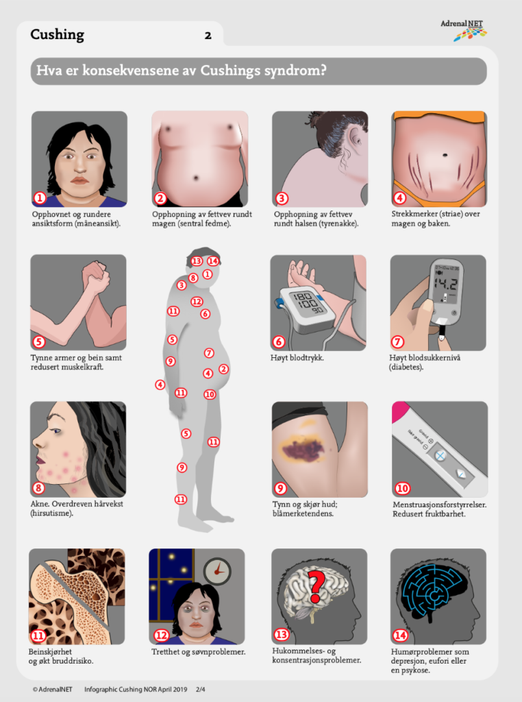 Hva-er-konsekvensene-av-Cushings-syndrom-infographic-NOR-2